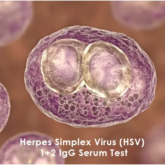 Herpes Simplex Virus 1+2 IgG Serum Test